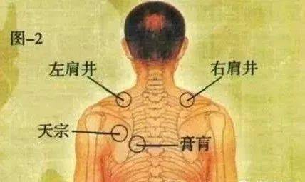 颈肩部位,主要灸透3个穴位:肩井,颈夹脊,大椎.