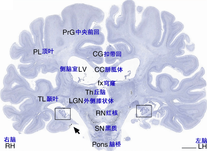 m.病人