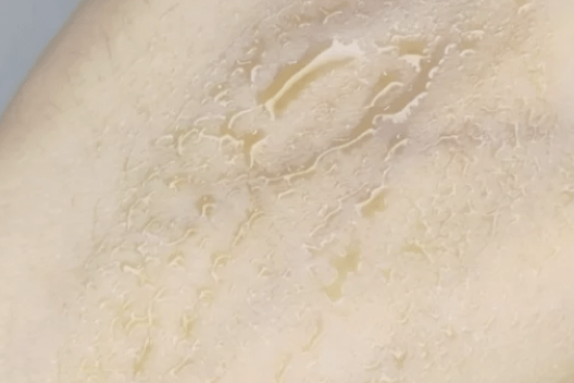 Truaxe|深扒The Ordinary