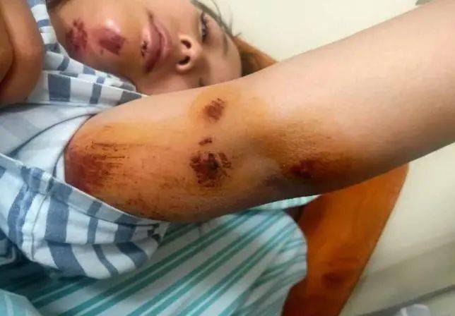 冲突|3岁儿子景区小便引冲突，母亲被推下20米悬崖？派出所：她身体失衡摔下去的