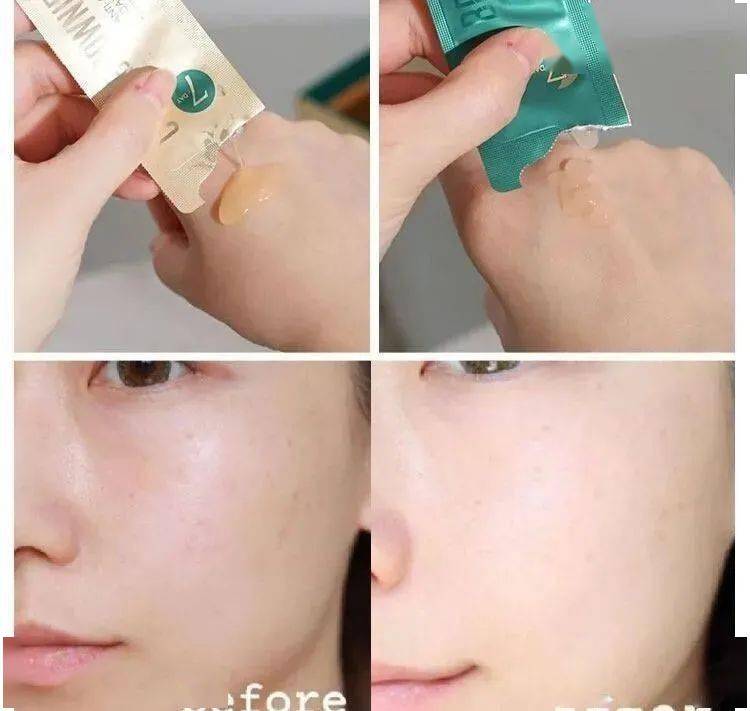 肌肤|40岁的年龄，18岁的脸，深扒“金喜善们”的冻龄术，竟然都是它！