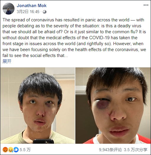 病毒|特朗普污名化中国几个月 我们该这样抵制种族歧视！