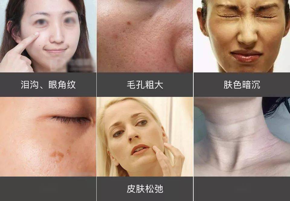 脸蛋|你的脸蛋“一键美颜”,除了滤镜还靠什么?