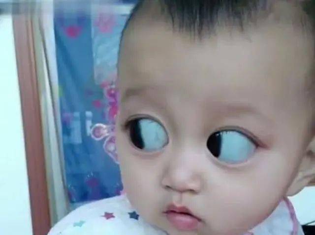 几个月大的宝宝能吃葡萄吗 86b3d3ca90cc48b681c9eff9ba1b3f34.jpeg