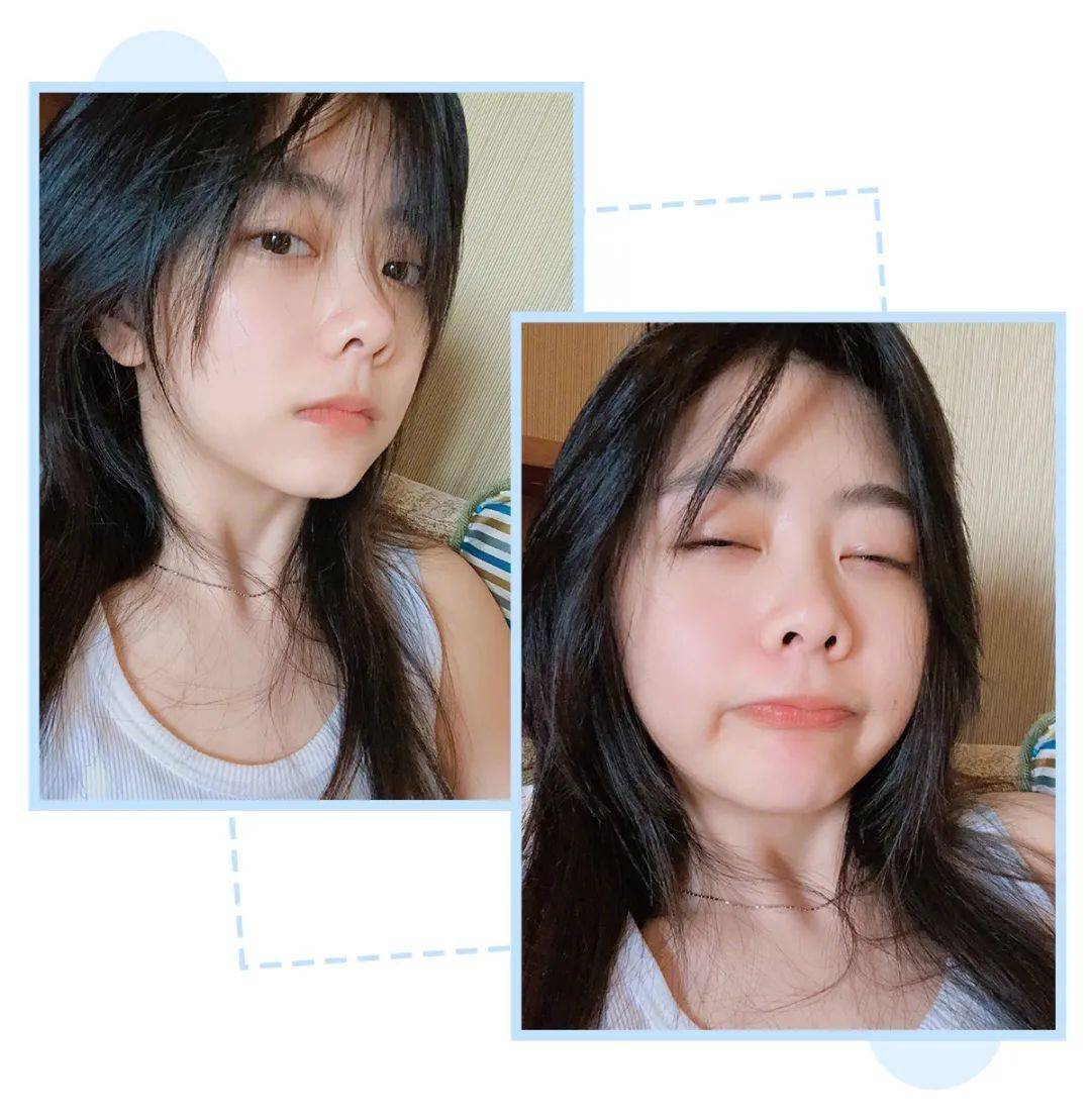 平价|终于体验了一个火遍全网的平价医美，真的有那么神奇？？