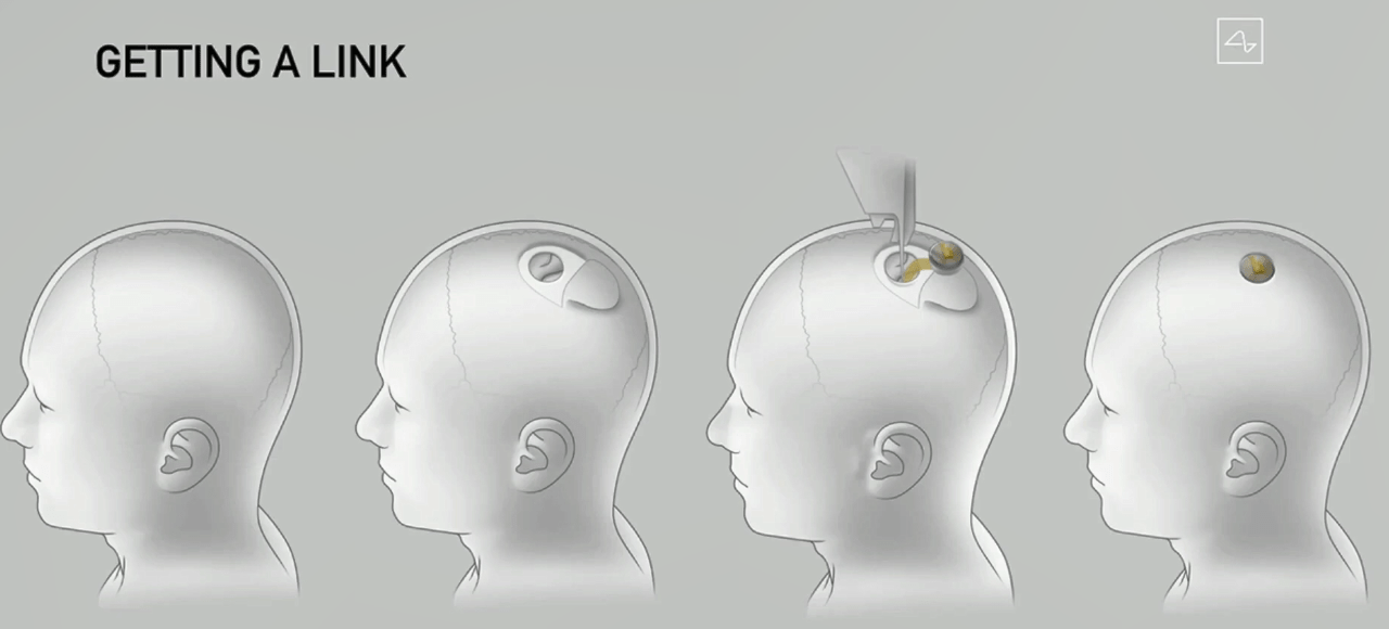 马斯克|电动车、可重复火箭之后，马斯克的脑机接口公司如何改变人类？