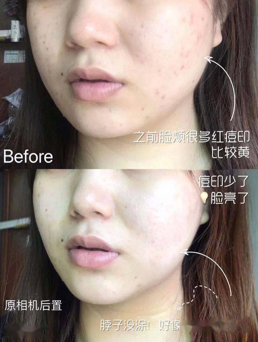 原液|对不起!HFP这么大的优惠我说晚了!!