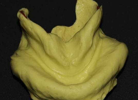 活动义齿怎么取下来 a379210f7e1347b7b5a5a2aadca7d4b3.jpeg