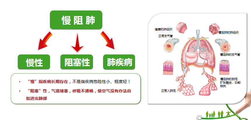 在我国40岁及以上人群中,慢阻肺的患病率已上升至14,每年约有100万人