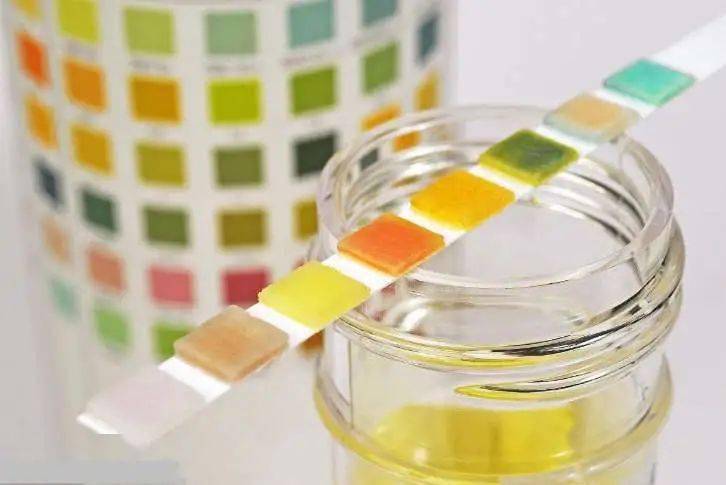 尿液|箭头高高低低看不懂？不懵圈、不求人，一篇教你看懂尿常规！