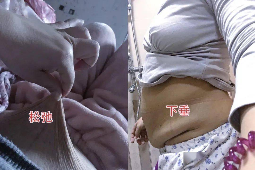 日本变态腹部抽脂带每25分钟胜过卷腹368次狂甩游泳圈get女团腰就靠它