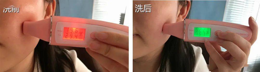 痘痘|背上长痘？神奇“液体”硫磺皂，60秒揪出万千螨虫，李佳琦卖了3万瓶！