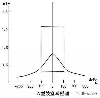 3ml,多见于中耳积液,耳咽管阻塞,也可见于耳膜穿孔c型(负压型)鼓室图