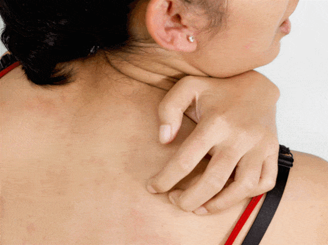 痘痘|背上长痘？神奇“液体”硫磺皂，60秒揪出万千螨虫，李佳琦卖了3万瓶！