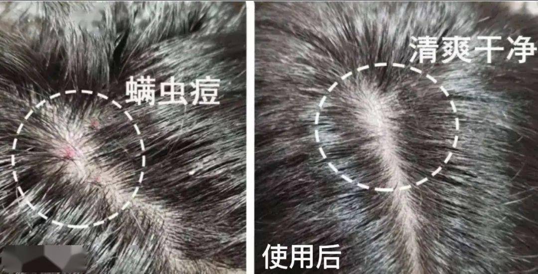 滋养液|32年才做成的育发液!让你挑战30天+生出小绒毛