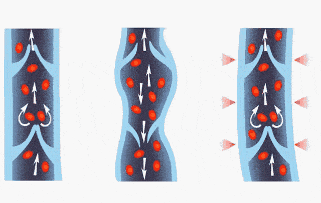 腿部|吴昕录制《乘风破浪的姐姐》都在用它,难怪万年小粗腿翻身成腿精!小腿细得像打了瘦腿针!