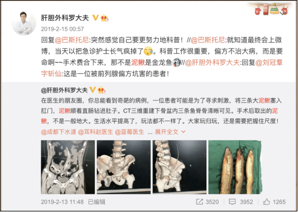 肛门|医生在直肠里找到了啤酒杯、罗非鱼、茄子、灯泡、泥鳅.....