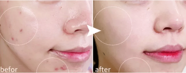 肌肤|还在敷“过气面膜”？！这款不到40元的爆款面膜让你换季肌肤都能水水润润！