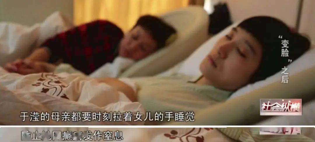 畸形|“我花100万，把女儿整成了残废”：畸形审美毒害下，有20万女孩正在消失！