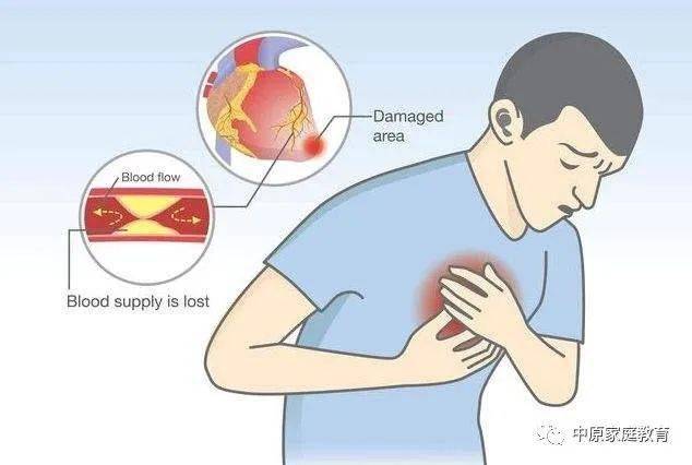 做过8000例手术医生总结的心梗预兆,你绝对意想不到!