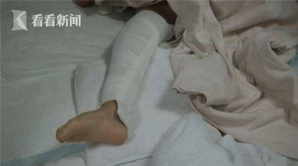 孩子|家长忘拔电动车钥匙 3岁孩子骑车撞墙被送进ICU