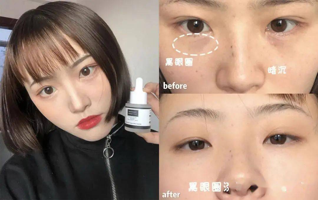 贫民窟|杨幂熬夜后护肤要花2万块？怪不得皮肤吹弹可破！贫民窟女孩就不配消除熬夜痘、黑眼圈吗？