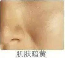 贫民窟|杨幂熬夜后护肤要花2万块？怪不得皮肤吹弹可破！贫民窟女孩就不配消除熬夜痘、黑眼圈吗？