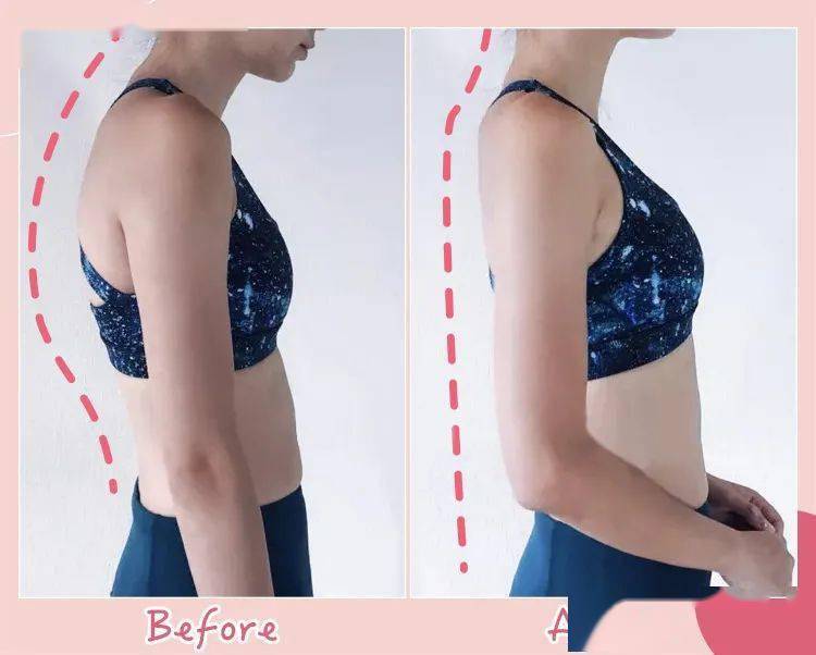 智商|张雨绮的矫姿带到底是智商税，还是真女神制造机？