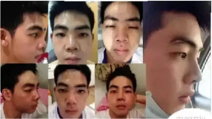 生活|泰国小哥花15万整形，成功从屌丝逆袭变男神！