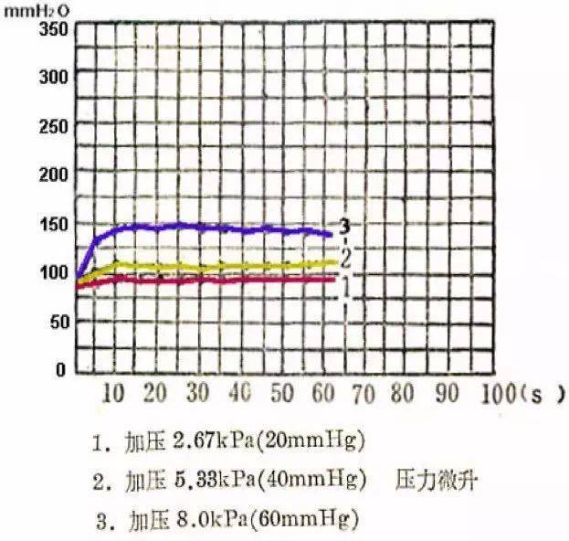 试验|腰穿测压一定要下肢伸直?腰穿检查 6 问 6 答