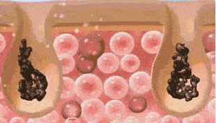 贫民窟|杨幂熬夜后护肤要花2万块？怪不得皮肤吹弹可破！贫民窟女孩就不配消除熬夜痘、黑眼圈吗？