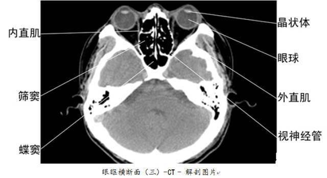 全身ct图谱,必须收藏!