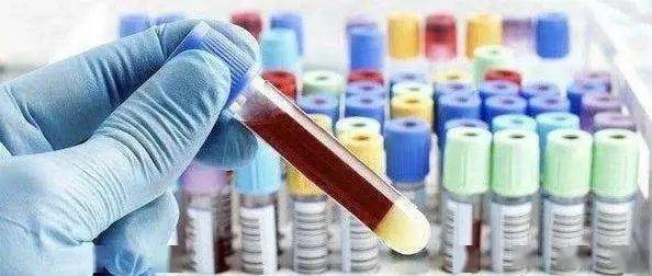 血糖|测血糖：选手指还是静脉？