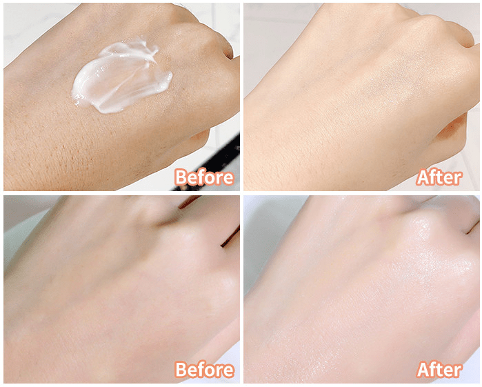 肌肤|因为粗糙的手,丢了颜值还越来越自卑,还好有它拯救了....