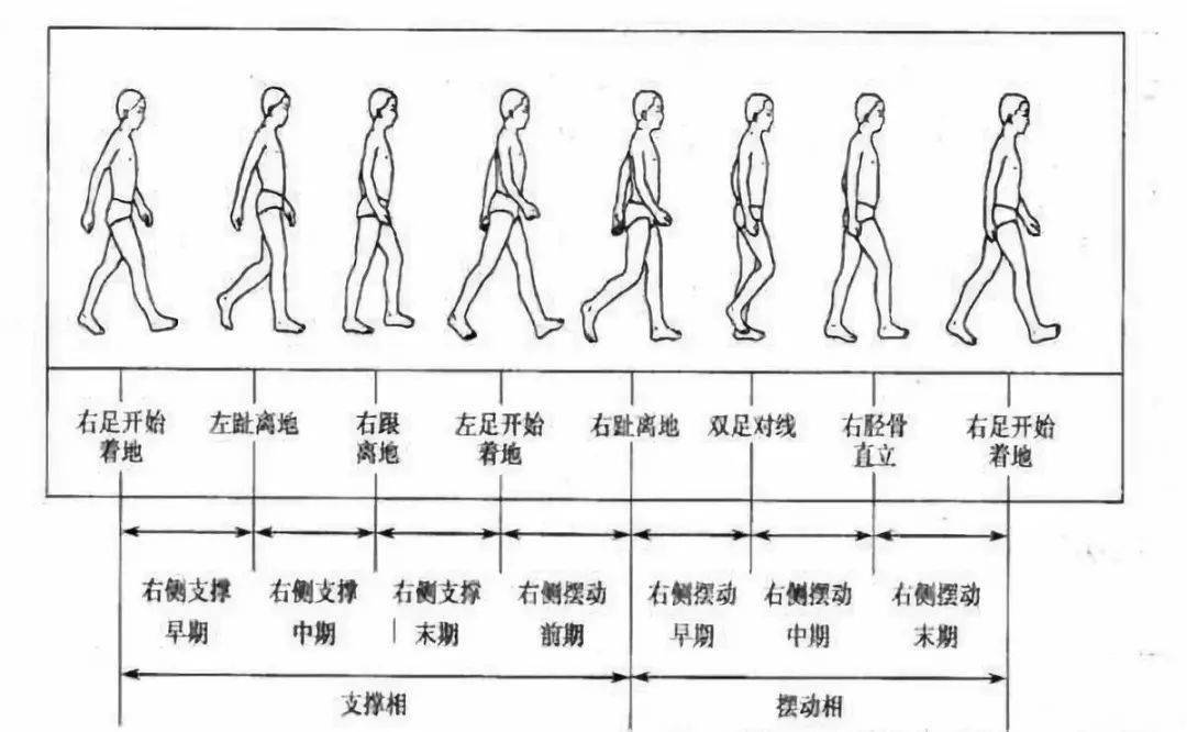 常见异常步态及矫治训练方法图文详解值得收藏