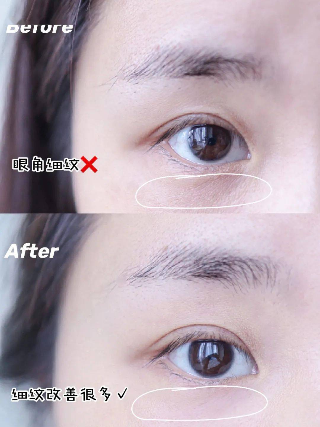 杭宝|4周即可快速淡纹?IPSA淡纹神器杭城首发!限时独家特惠必入不容错过!