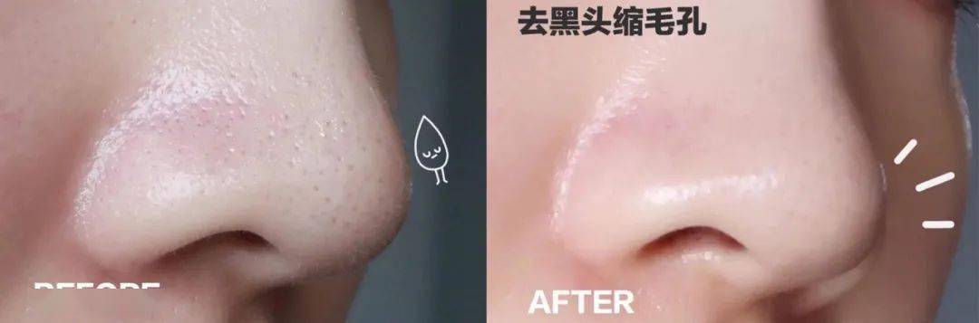 小气泡|花9块钱在福州这家店做了医美,做完就后悔了!