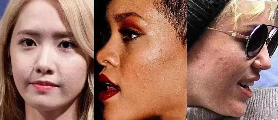 潘达|日本20年老木头,经1300°高温烧成“变态黑炭”,几分钟溶掉黑头,太神奇!