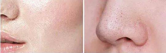 潘达|日本20年老木头,经1300°高温烧成“变态黑炭”,几分钟溶掉黑头,太神奇!