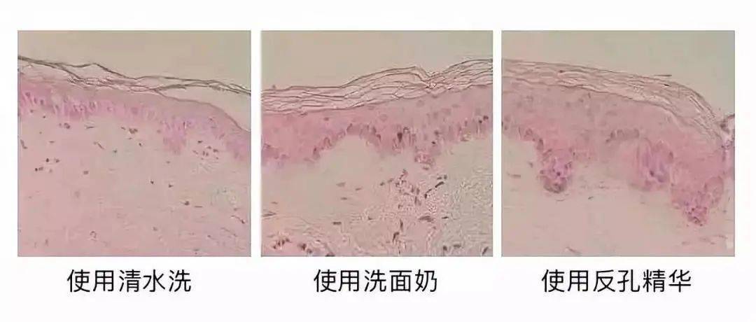 潘达|日本20年老木头,经1300°高温烧成“变态黑炭”,几分钟溶掉黑头,太神奇!