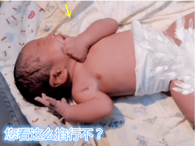 宝宝|把自己掐哭：不用动手我自己来新生宝宝怕被医生“打”