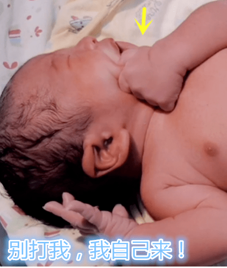 宝宝|把自己掐哭：不用动手我自己来新生宝宝怕被医生“打”