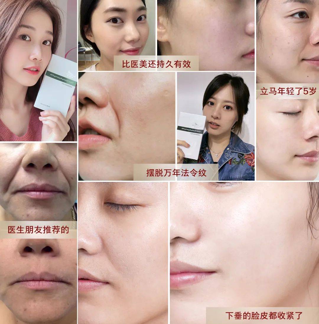 网友|47岁阿姨直播，“法令纹”2分钟磨平！网友炸锅：神仙操作！