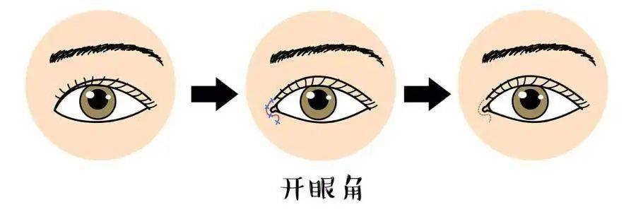 双眼皮|为什么“整容脸”女孩,更受直男欢迎?