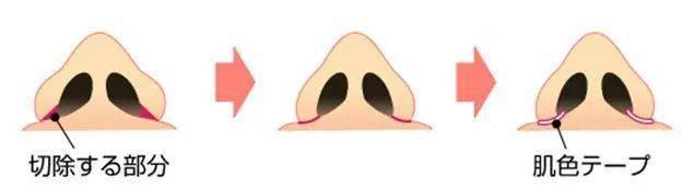 双眼皮|为什么“整容脸”女孩,更受直男欢迎?