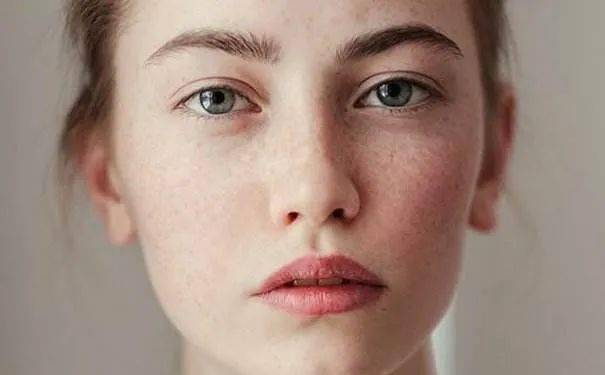 
为什么有些女性脸上容易长斑？或是这三个原因 劝告你快重视起