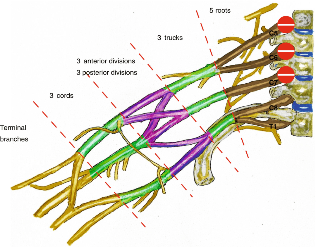 thoracic 甲状颈干(thyrocervical trunk 肋颈干(costocervical