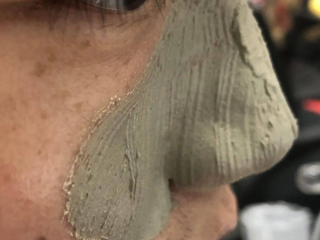 张天|长期闭口、粉刺、痘痘满脸的人，微镜头下毛孔竟然是这样的！赶紧get林允、张天爱的0毛孔秘籍吧！