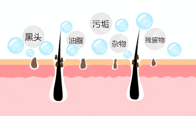 张天|长期闭口、粉刺、痘痘满脸的人，微镜头下毛孔竟然是这样的！赶紧get林允、张天爱的0毛孔秘籍吧！