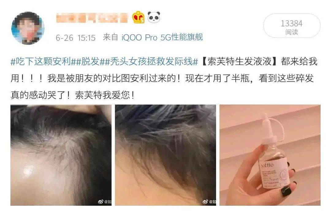 索芙特|超强国货生发!1个月发际线被填满,半年发量暴增!